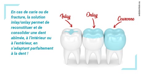 https://dr-jumeau-gersohn-corinne.chirurgiens-dentistes.fr/L'INLAY ou l'ONLAY