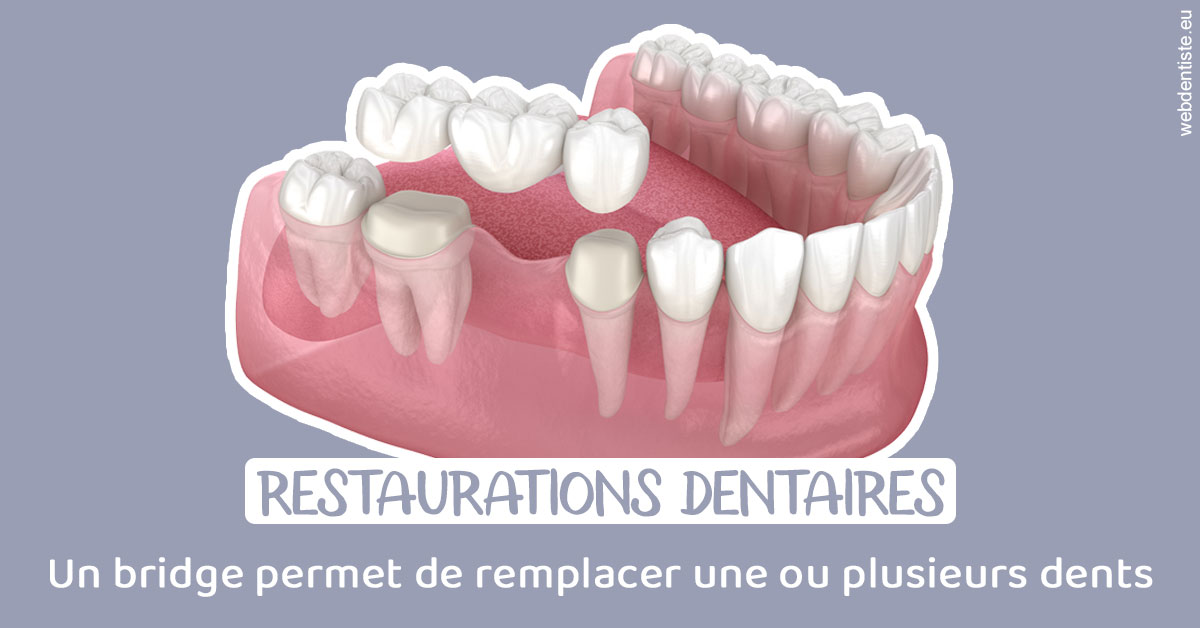 https://dr-jumeau-gersohn-corinne.chirurgiens-dentistes.fr/Bridge remplacer dents 1