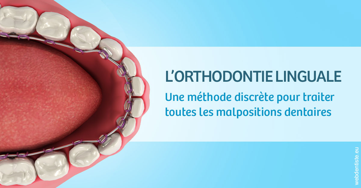 https://dr-jumeau-gersohn-corinne.chirurgiens-dentistes.fr/L'orthodontie linguale 1