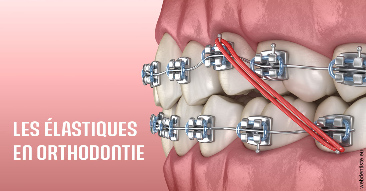 https://dr-jumeau-gersohn-corinne.chirurgiens-dentistes.fr/Elastiques orthodontie 2