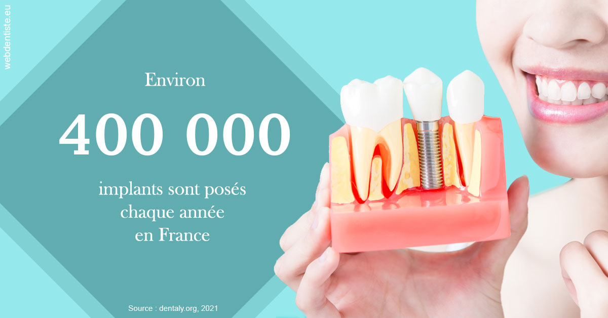 https://dr-jumeau-gersohn-corinne.chirurgiens-dentistes.fr/Pose d'implants en France 2