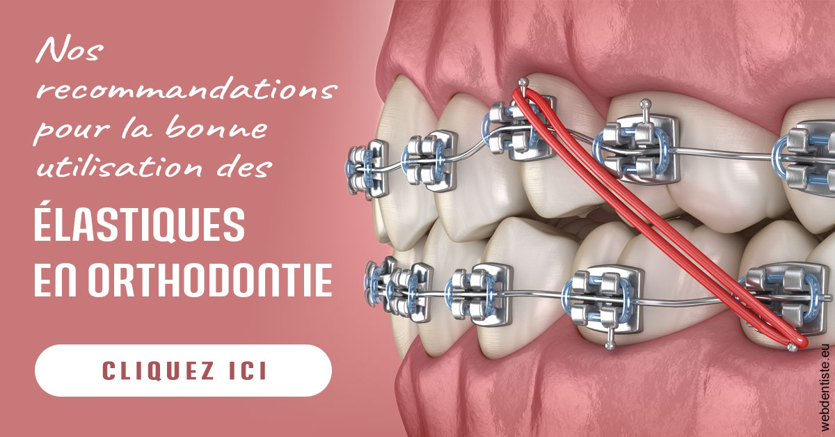 https://dr-jumeau-gersohn-corinne.chirurgiens-dentistes.fr/Elastiques orthodontie 2